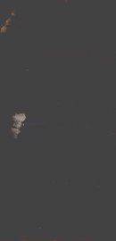 伤寒论研究  卷1-2 - 封面图